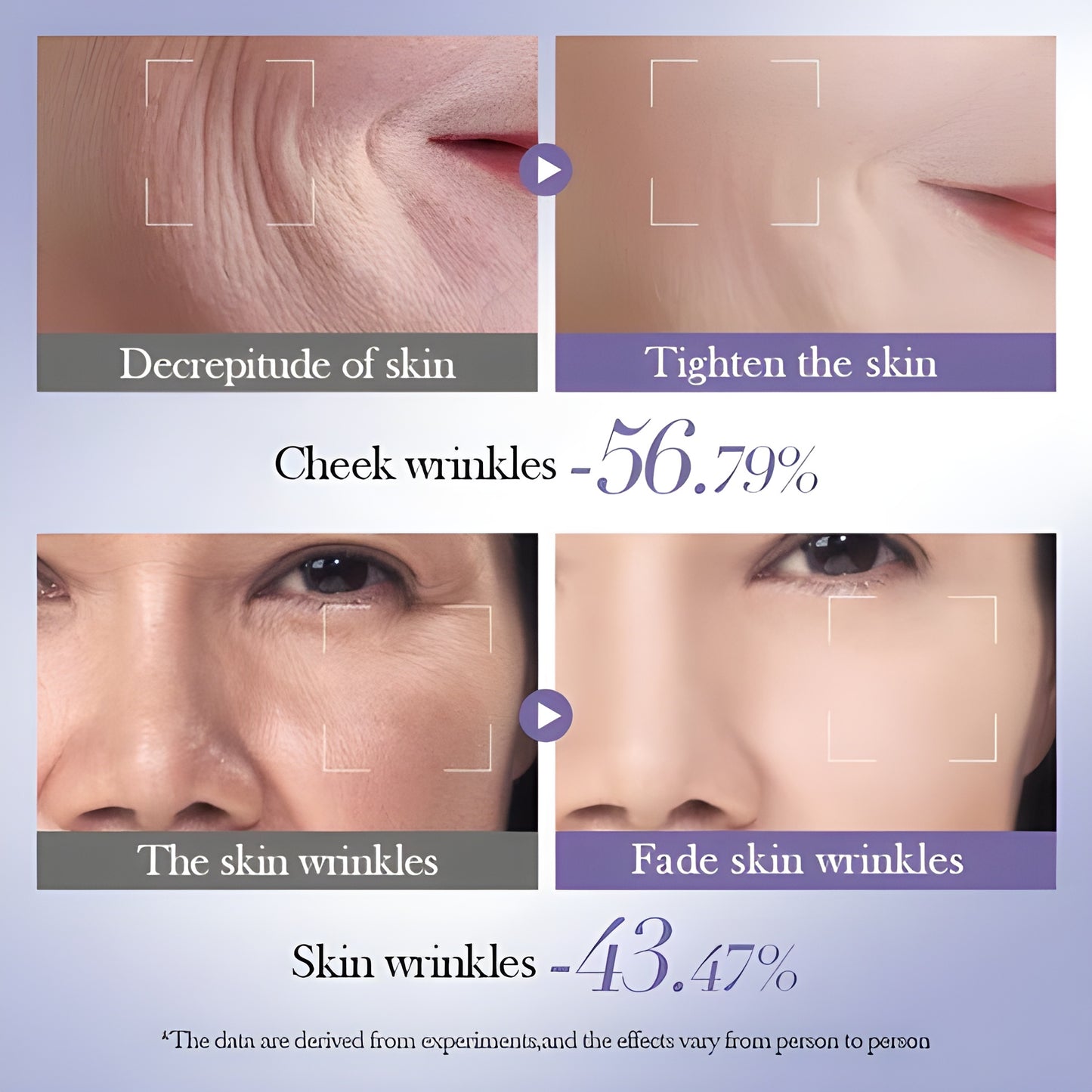 Bioaqua - Retinol Skin Set (Original) | Anti Ageing Treatment | Anti Wrinkle Treatment